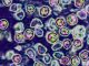 Unvaccinated Pennsylvania woman died of measles complications, coroner says