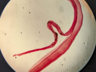 Woman's brain worm infection confirmed after eggs grow tails in lab test