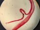 Woman's brain worm infection confirmed after eggs grow tails in lab test